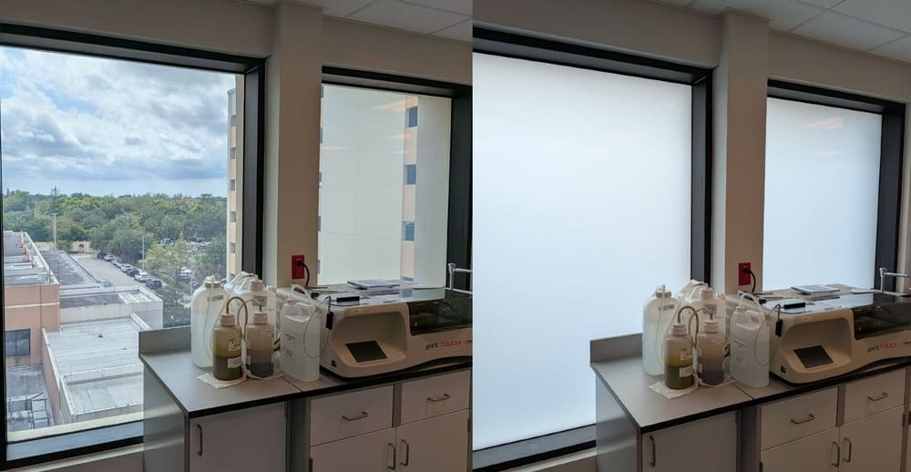 Smart privacy glass for hospitals